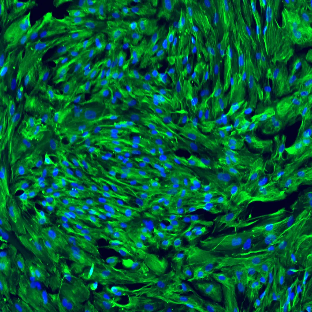 Vascular Leptomeningeal Cells (VLMCs) & Blood-Brain Barrier Function