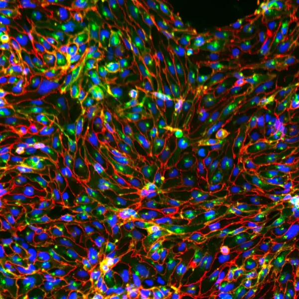 Trailhead Biosystems Endothelial Cells