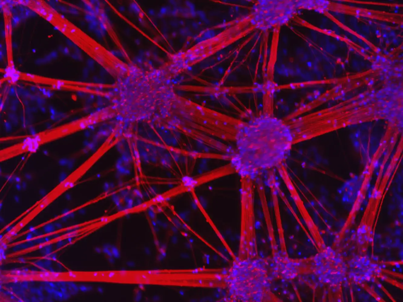 Parkinson’s Disease and A9 Dopaminergic Neurons: Exploring Genetic and Physiological Vulnerabilities