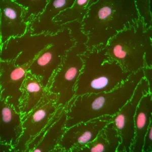 TrailBio<sup>®</sup> Endothelial Cells